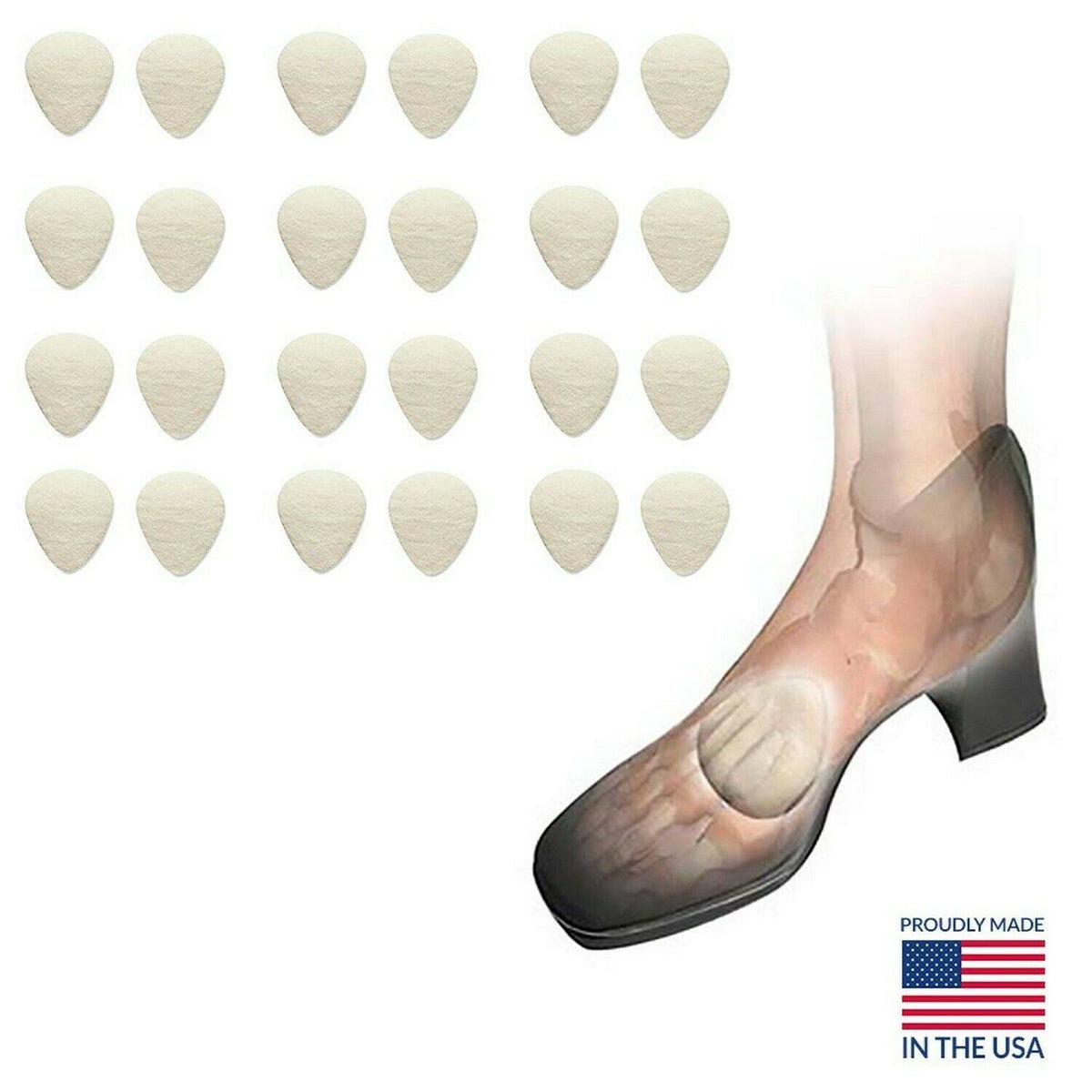Metatarsal Cookies, 5/16 inch, Case of 12 Pairs E67393